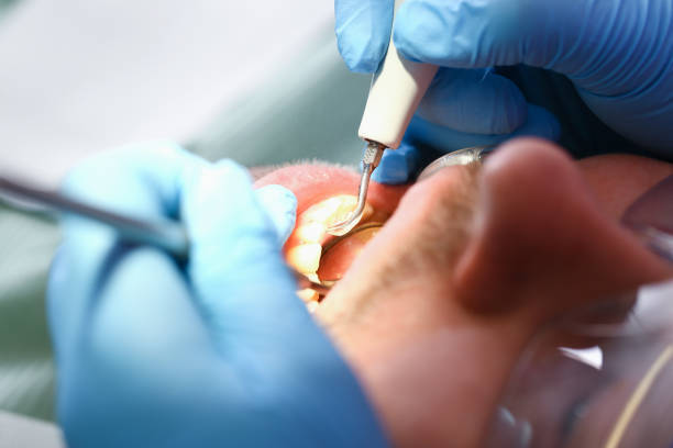 Best Emergency Tooth Extraction  in Williamstown, WV